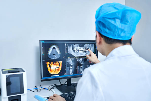 Best Emergency Dental Care for Broken or Chipped Teeth in Rancho Palos Verdes, CA