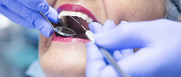 Best Urgent Care for Lost Fillings or Crowns in Rancho Palos Verdes, CA